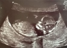 Pregnancy and a Plant-Based/Vegan Diet